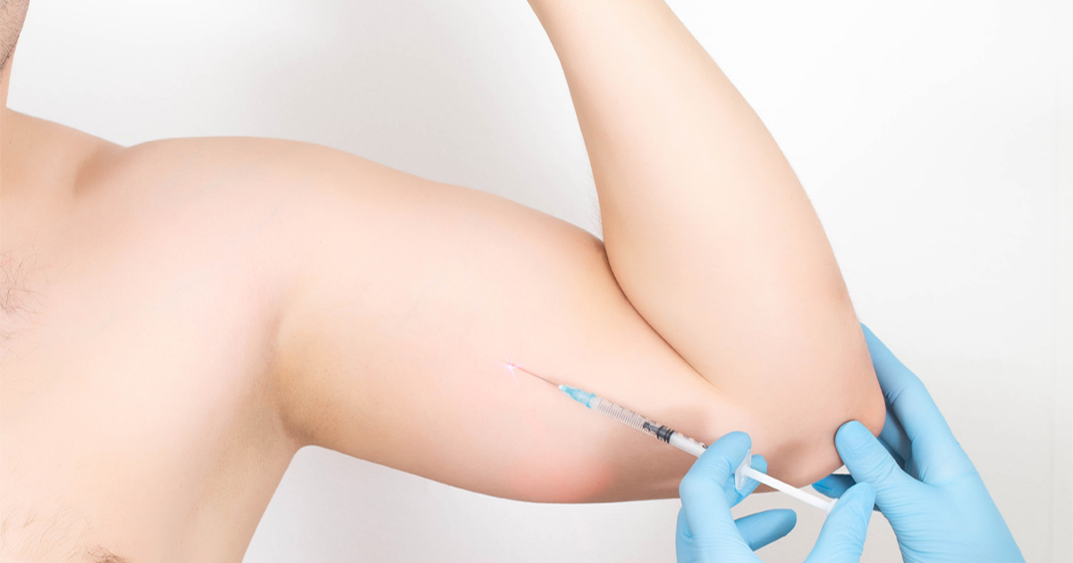 peptide therapy for recovery helping muscle repair and tissue healing